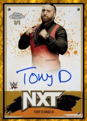 Tony D'Angelo